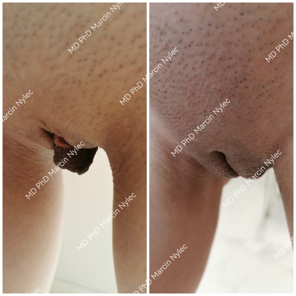 Transformasjon fra estetisk kirurgi - detaljerte bilder.