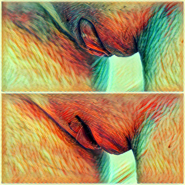 Overflødig klitorisforhud ser ut som en mikropenis